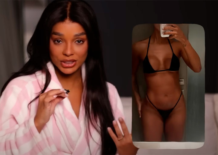 “Todo mundo achava que meu corpo ia voltar rapidinho, mas não voltou”, desabafa Brunna