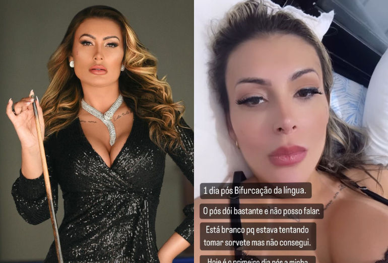 Imagens fortes: Andressa Urach choca ao realizar procedimento que divide a língua ao meio